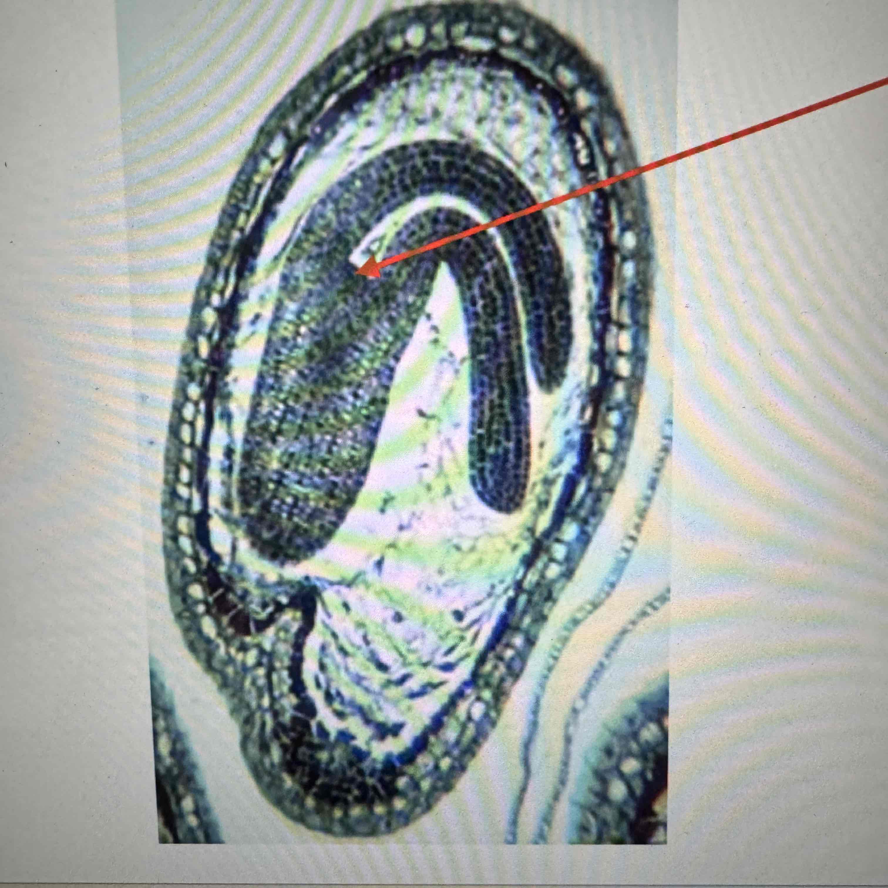 <p>what part of the Angiosperm embryo is the arrow pointing to?</p>