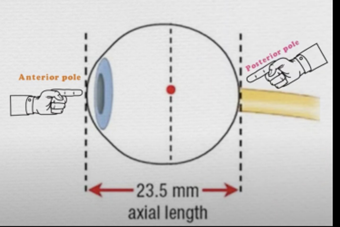 <p>D. The measure of length from the anterior cornea to the posterior retina</p>