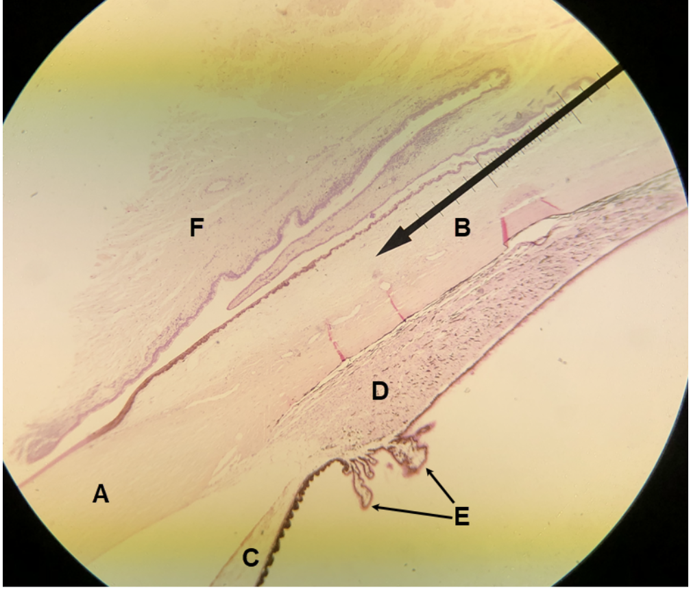 <p><span><span>In the image above, identify structures/parts of the eye wall A and B, and structures C-F. &nbsp;For G, name the structure that consists of D and E together.</span></span></p>