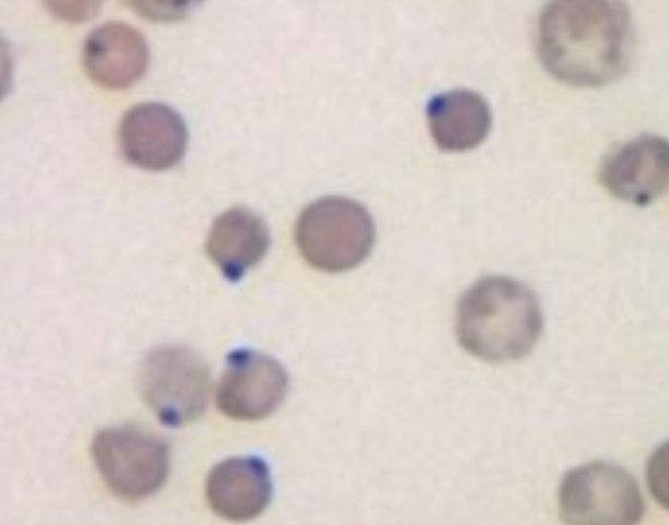 <p>are formed by oxidation of exposed sulfhydryl grps on hb</p>