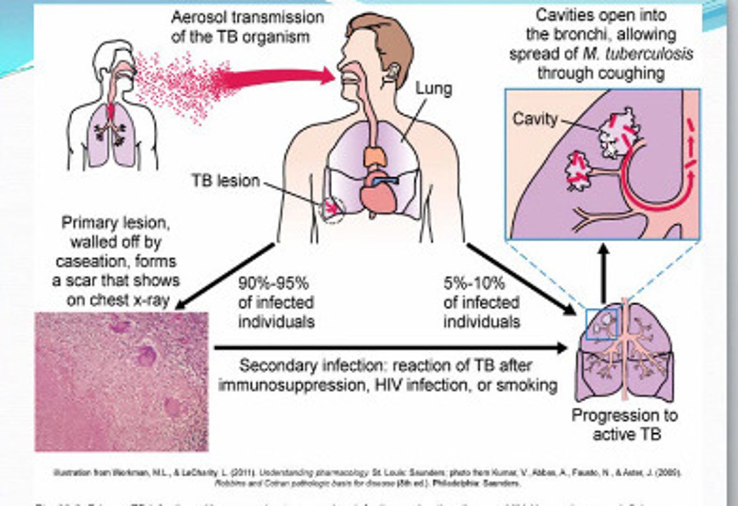 <p>- spread by airborne droplet nuclei</p><p>- transmission affected by: infectiousness of patient, environmental conditions, and duration of exposure</p><p>- most people who are exposed do not become infected</p>