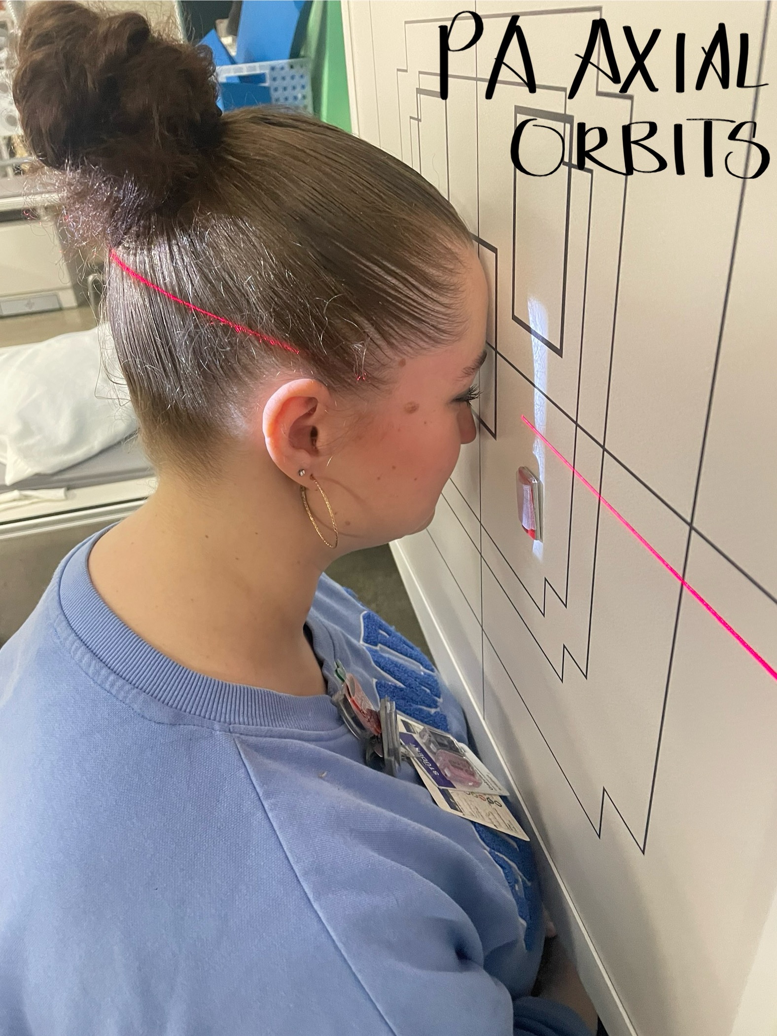 <p>Pt position: PA. OMBL perpendicular to IR </p><p>CR entrance: Inf. rim of orbits per Merrills (more like sup. rim IRL) </p><p>tube angle: 25 degrees caudal </p><p>SID: 40”</p><p>Size IR : 10 × 12 </p><p>Collimation: Can cut off jaw. Should see light beyond sides of head. </p><p>Breathing: suspend</p><p>Anatomy: need orbits and maxillary sinuses </p>