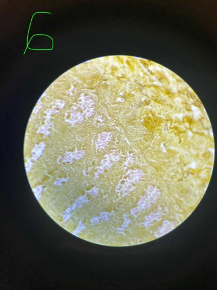 <p>What stain is this?</p>