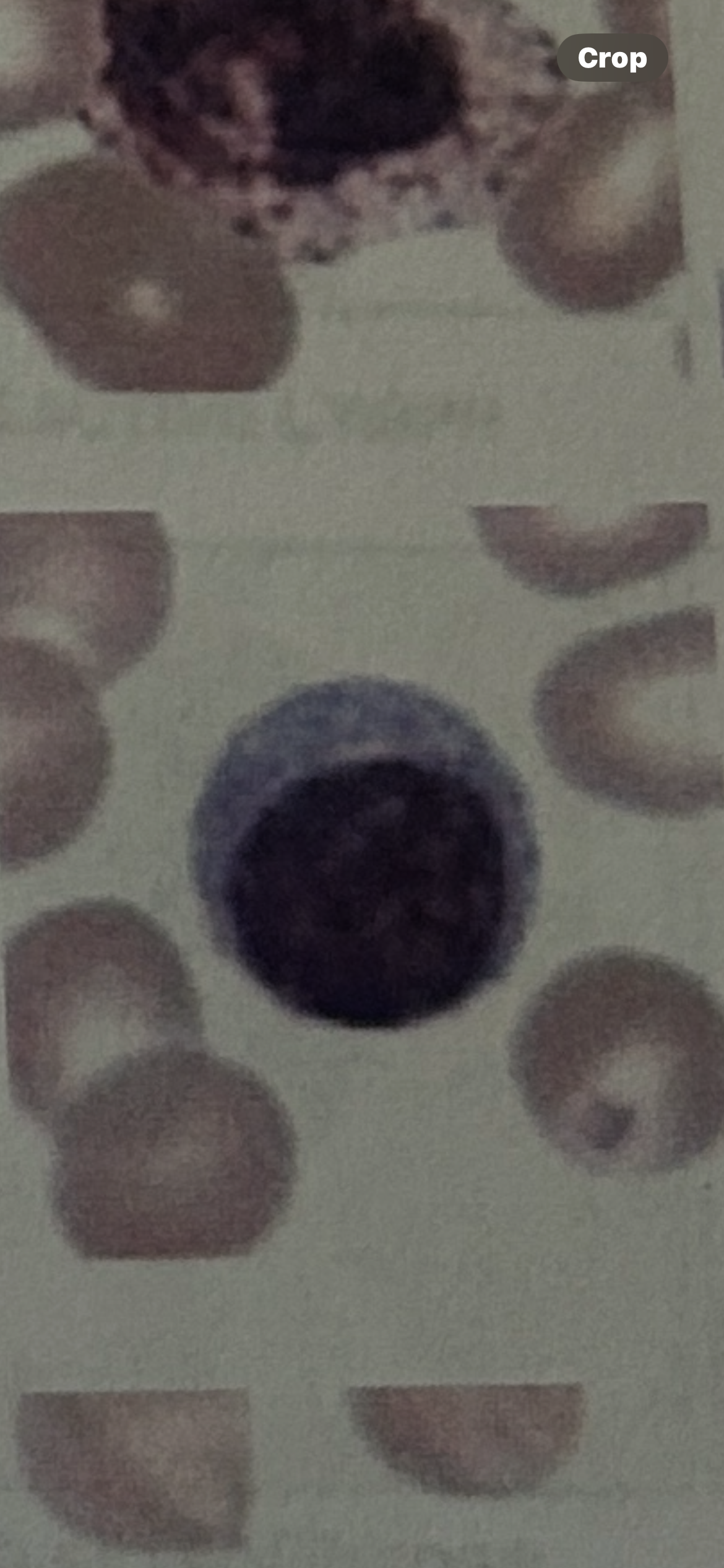 <p>WBC</p>