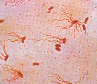 Typhoid Fever