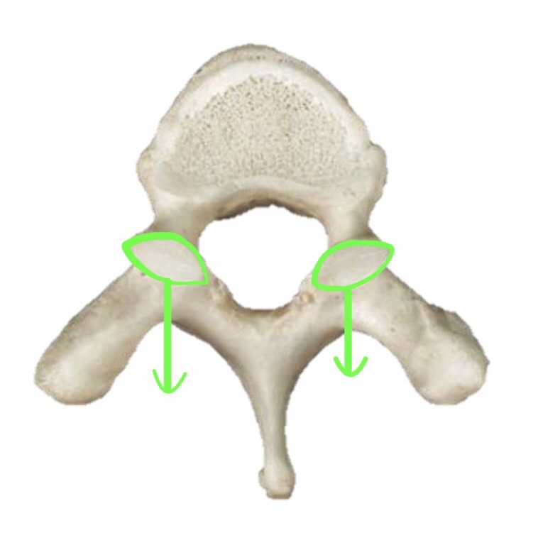 <p>What Bone Is This If The Facets Are Facing Downwards?</p>