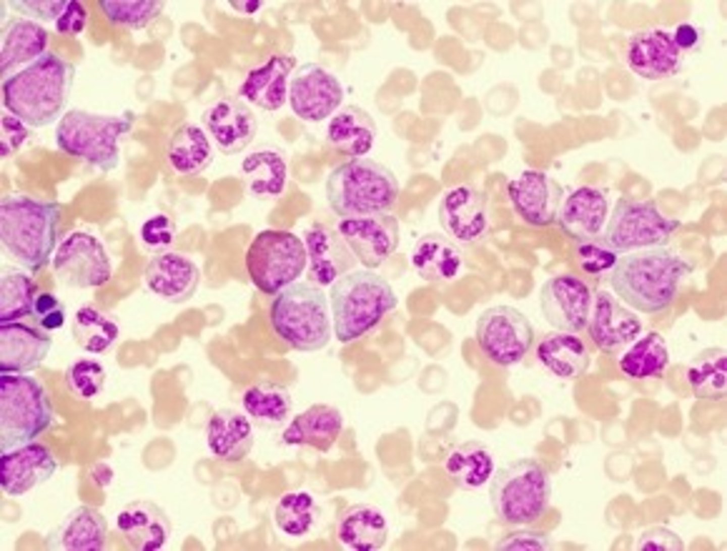 <p>A) Band cells</p>
