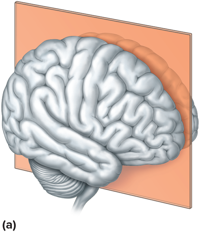 <p>Lengthwise cut that divides the body into left and right portions.</p>