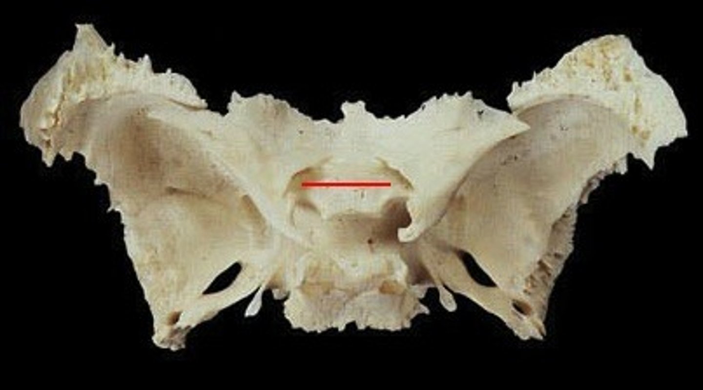 <p>Sphenoid bone - optic chiasm area</p>