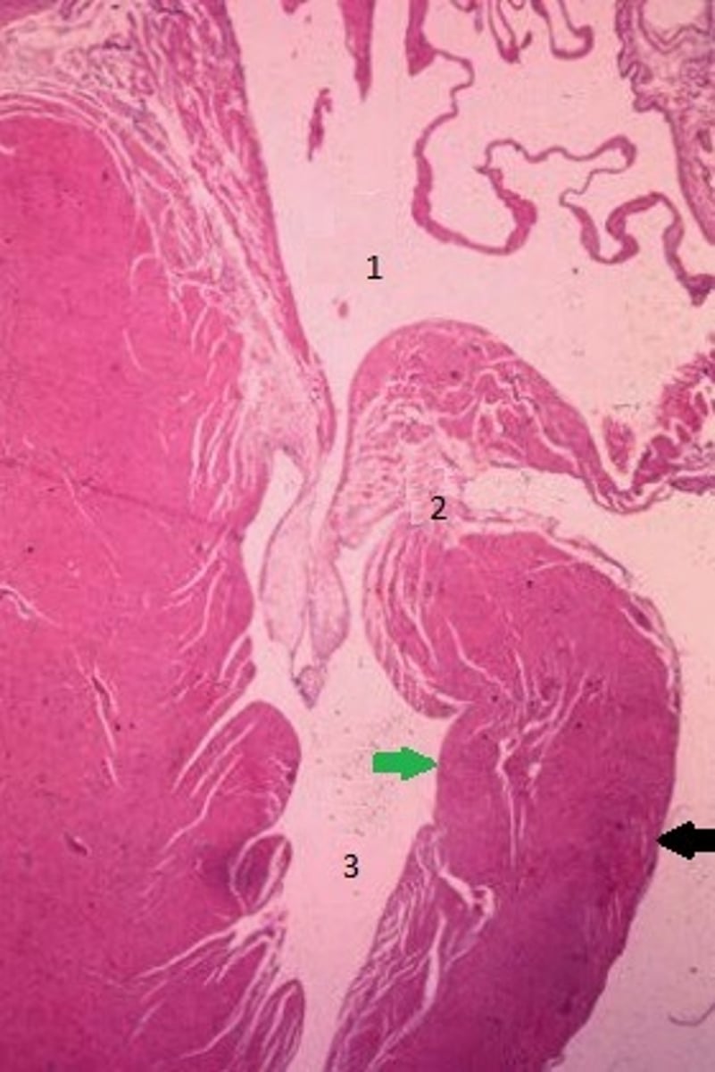 <p>Identify the 3 layers in the heart indicated by the green &amp; black arrows. Identify the spaces indicated by 1 &amp; 3. Identify the structure indicated by 2.</p>