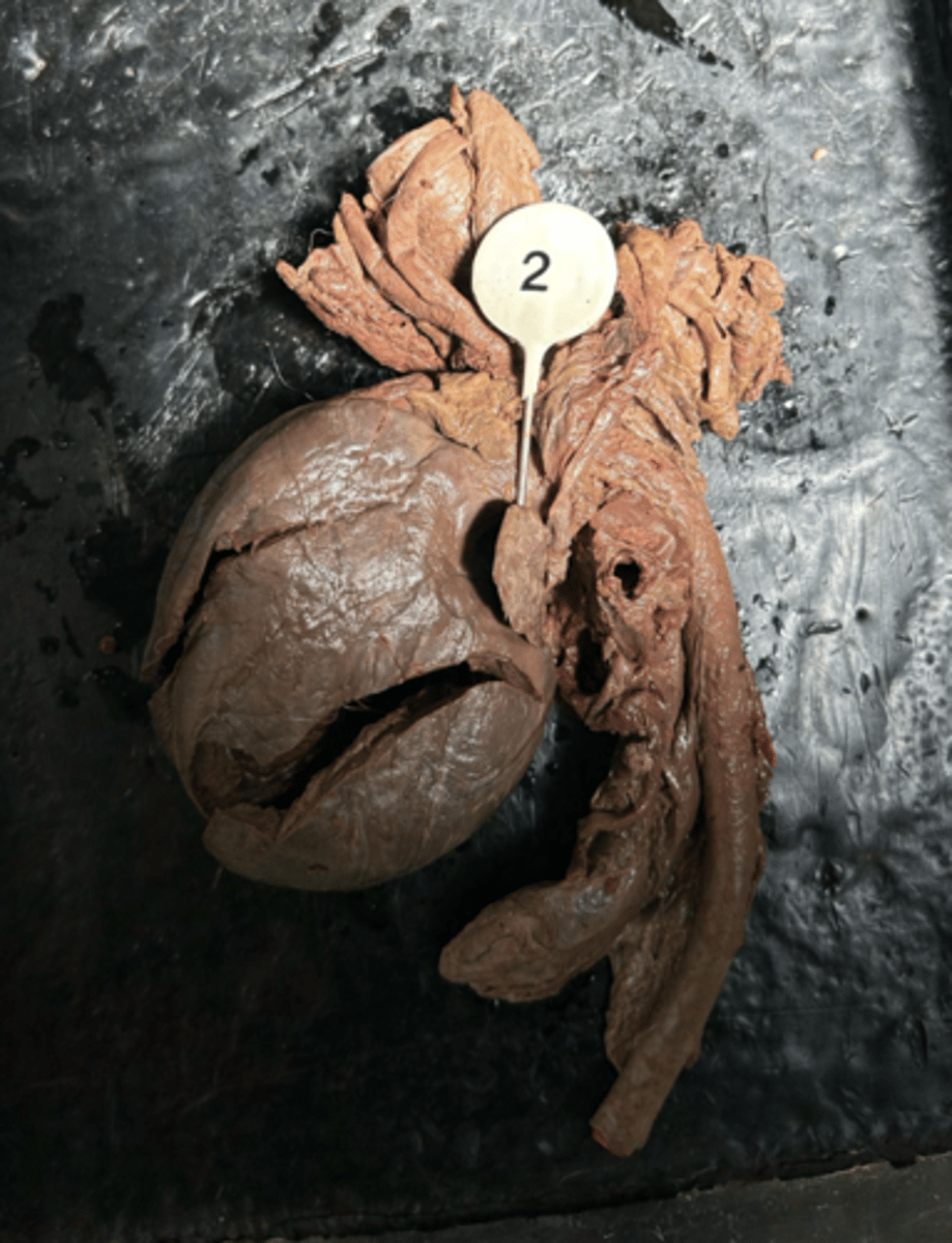<p>ID the specific structure pierced by the pin.</p>