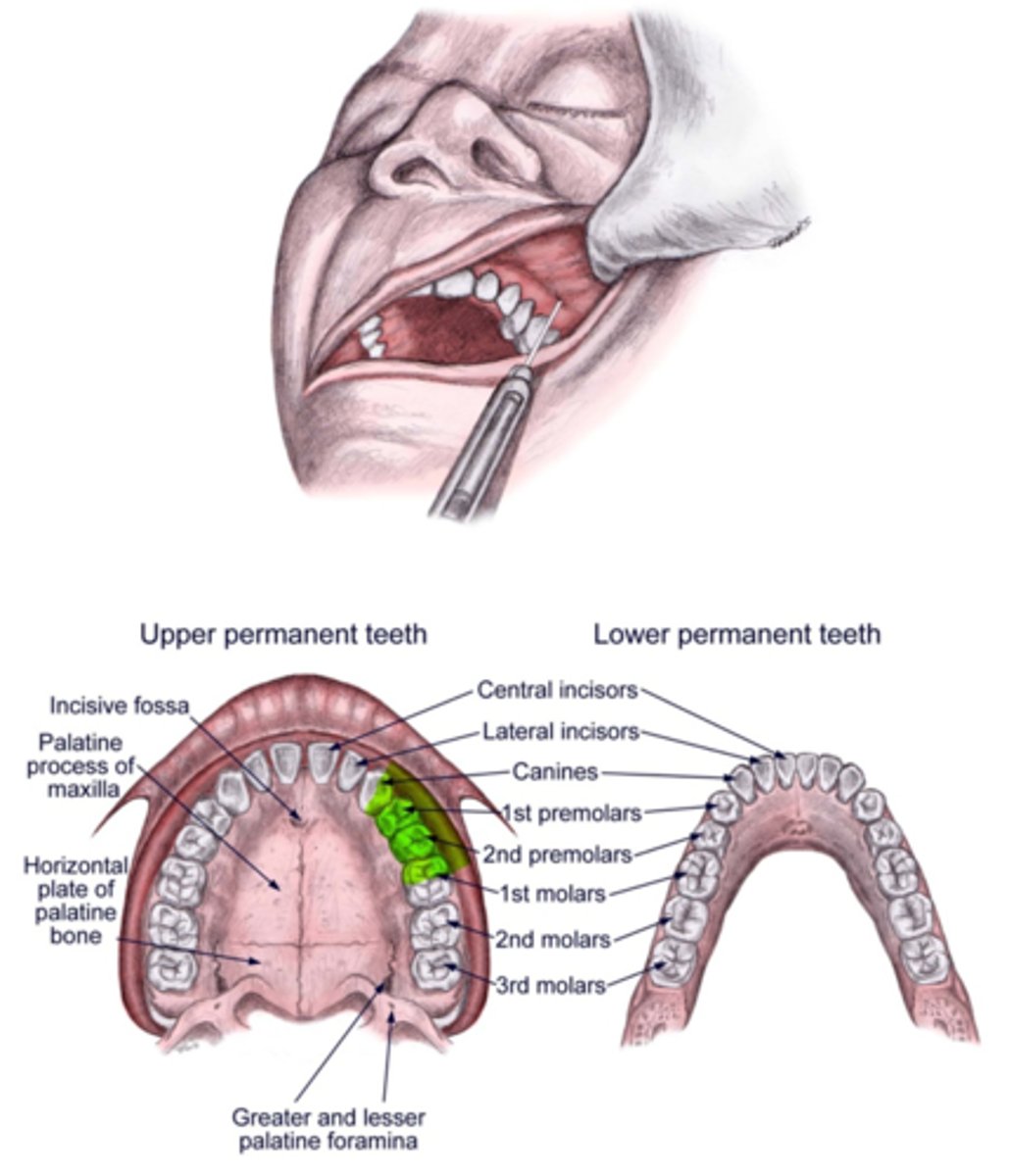 <p>Max Premolars and the MB root of Mx 1st molar, AND the facial gingival tissue</p>