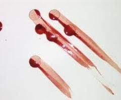 -A bloodstain pattern created when an object moves through an existing stain, removing and/or altering its appearance