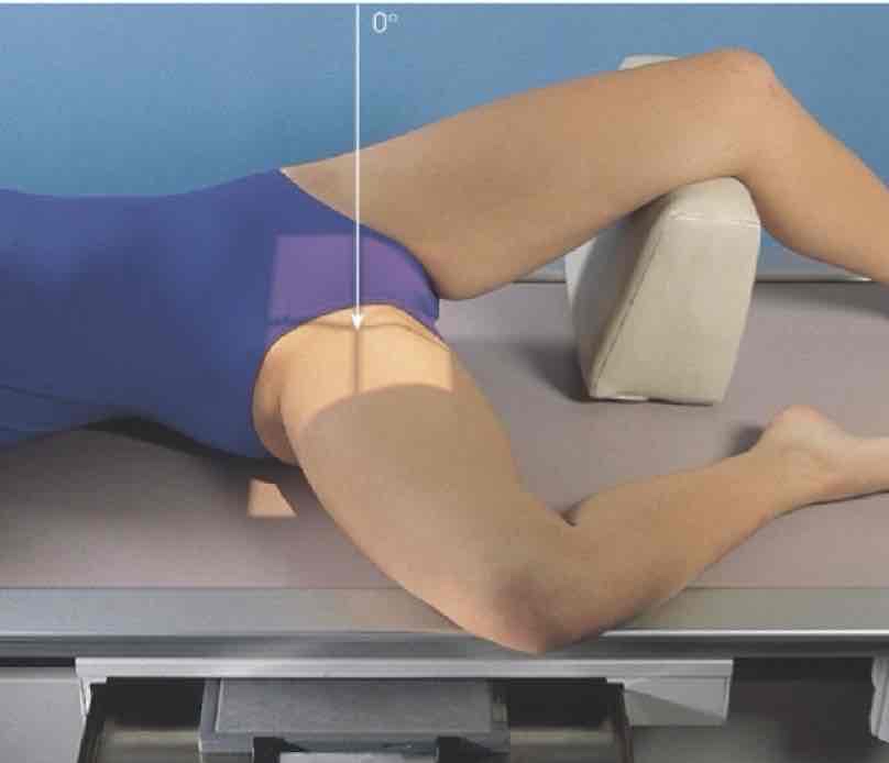 <p>What Projection is this?</p>