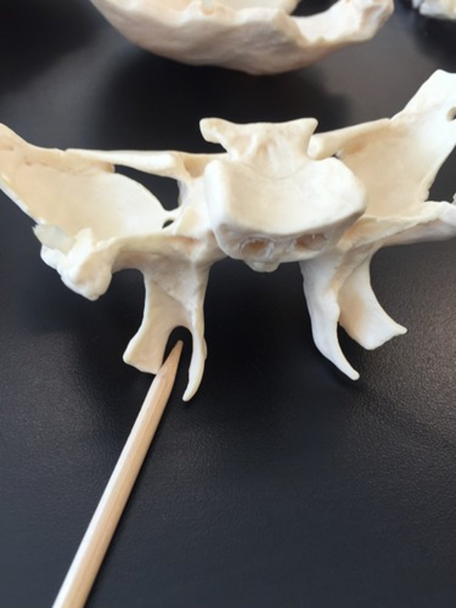 knowt flashcard image