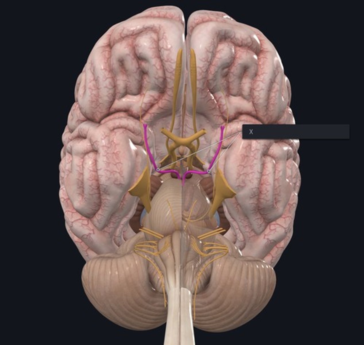<p>Name the Nerve highlighted purple and indicated by the X.</p>
