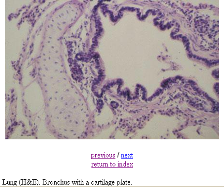 <p><strong>Bronchus</strong></p><p><em>Has cartilage. Bronchioles will not have cartilage</em></p>