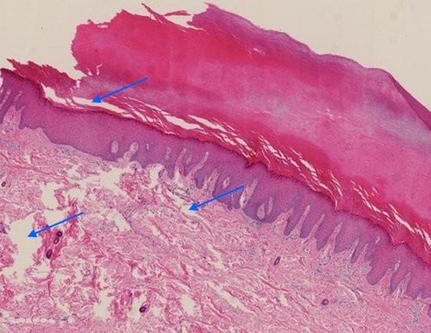 <p>A type of epithelium with multiple layers of flat cells, keratinized in skin.</p>