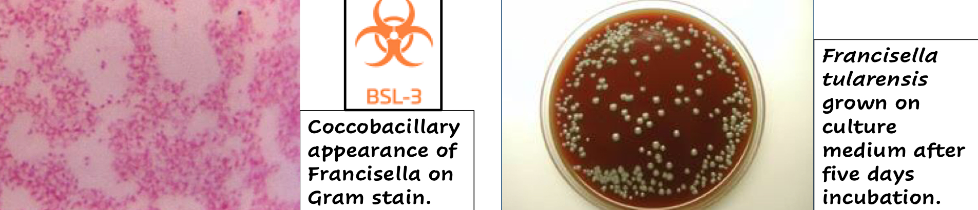 <ul><li><p>Gram -</p></li><li><p>Non-motile</p></li><li><p>Capsulated coccobacilli</p></li><li><p>Obligate Aerobe</p><ul><li><p>Therefore oxidase +</p></li></ul></li><li><p>Requires <span style="color: rgb(223, 0, 255);"><strong><u>cysteine</u></strong></span> for growth</p></li></ul><p></p>