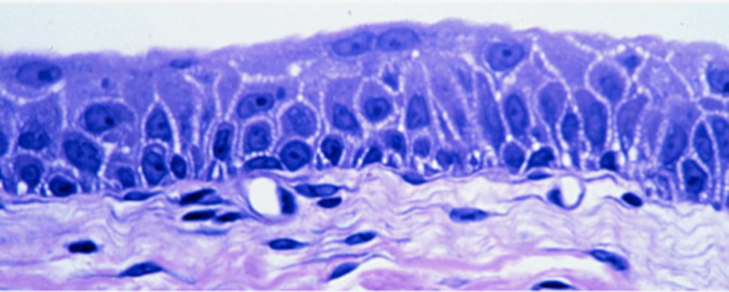 <p>Identify the type of epithelia</p>