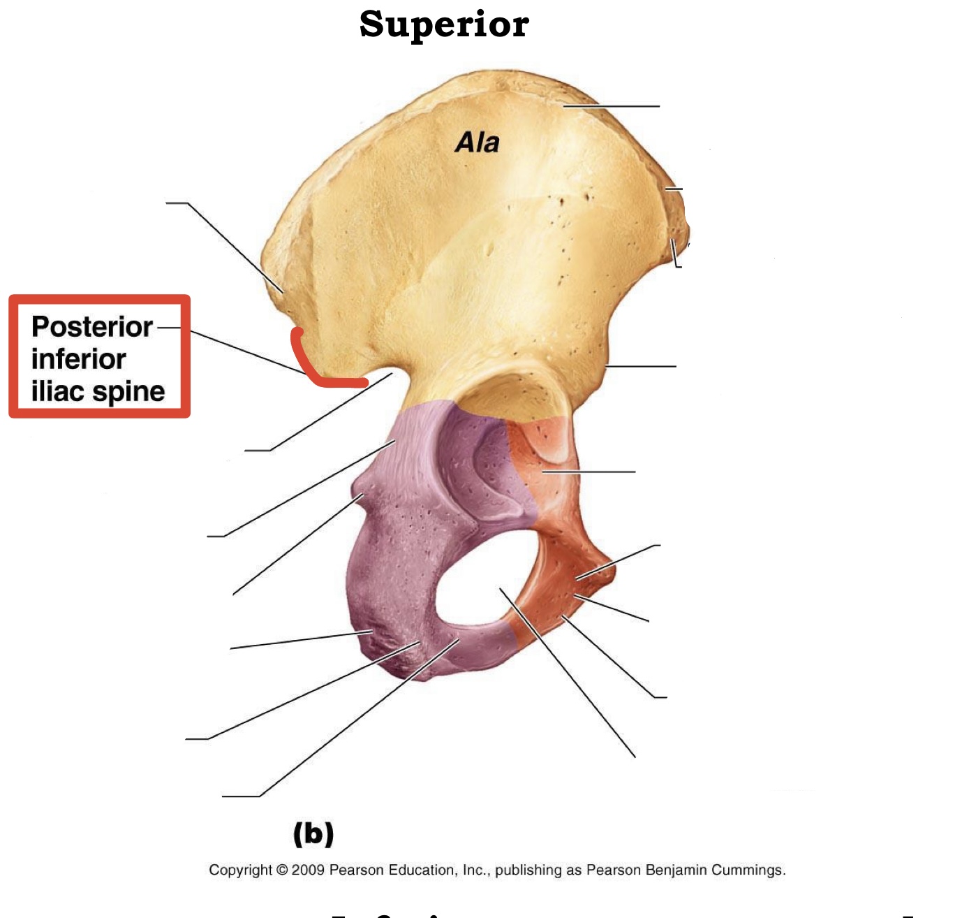 <p><span><span>Posterior inferior iliac spine</span></span></p>