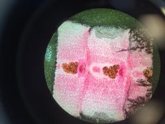 <p>What is the genus species of this gravid pseudotapeworm? Its definitive hosts are fish eating mammals (including man), and its intermediate hosts are aquatic crustaceans then large fish</p>