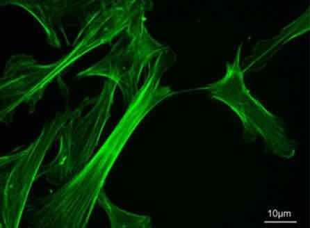 <p>Microfilaments</p>