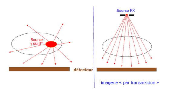 <p>La différence de ces 2 techniques par rapport à ce qu’on vient de voir avec la radiographie et le scanner c’est que la radiographie et le scanner sont des <span style="color: red"><strong>imageries dites de transmission</strong></span>, ce qui est radioactif est à l’extérieur du patient alors que pour l’imagerie nucléaire le patient est la source, c'est-à-dire qu'on injecte la source radioactive directement au patient. C'est donc de<u> </u><span style="color: rgb(170, 0, 255)"><strong><u>l'imagerie d'émission.</u></strong></span></p>