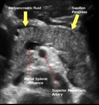 <p>Describe this image</p><p>Diagnosis?</p>