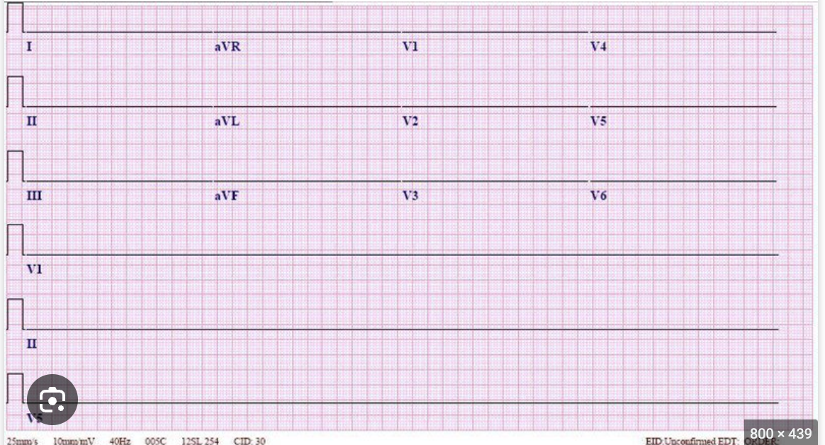 <p>Treatment for asystole?</p>