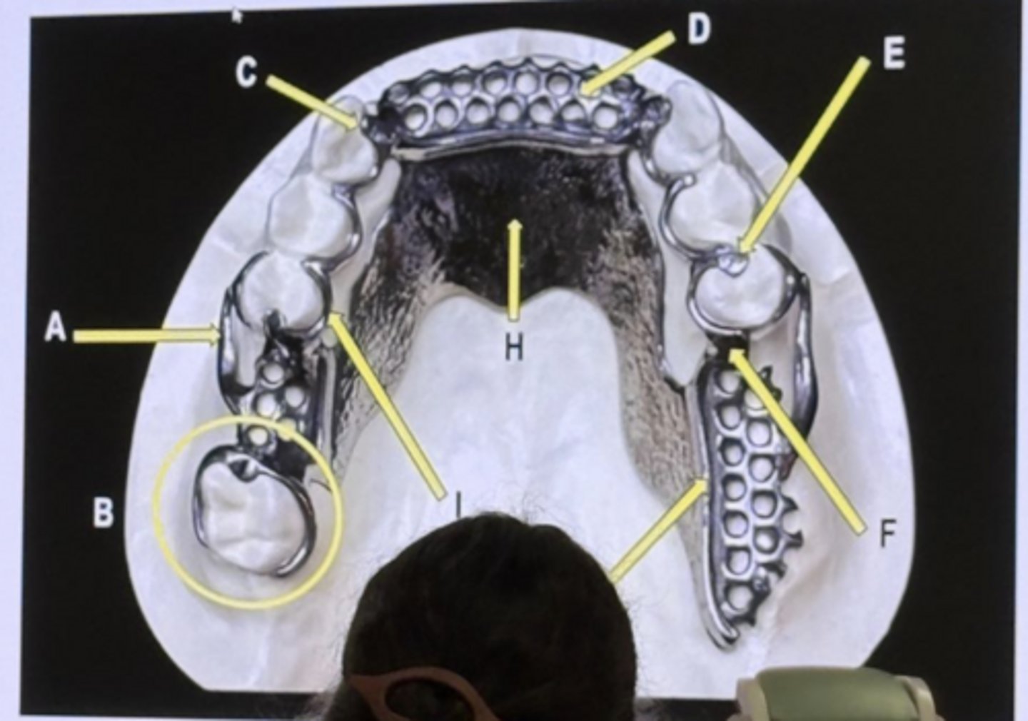 <p>retentive arm</p>