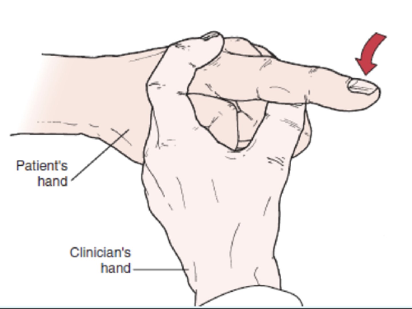<p>- identify tightness around PIP joint</p><p>- description: the proximal interphalangeal joint is held in a neutral position while the distal interphalangeal joint is flexed by the examiner. if the distal interphalangeal joint does not flex, the retinacular (collateral) ligaments or proximal interphalangeal capsule is tight. if the proximal interphalangeal joint is flexed and the distal interphalangeal joint flexes easily, the retinacular ligaments are tight and the capsule is normal.</p>