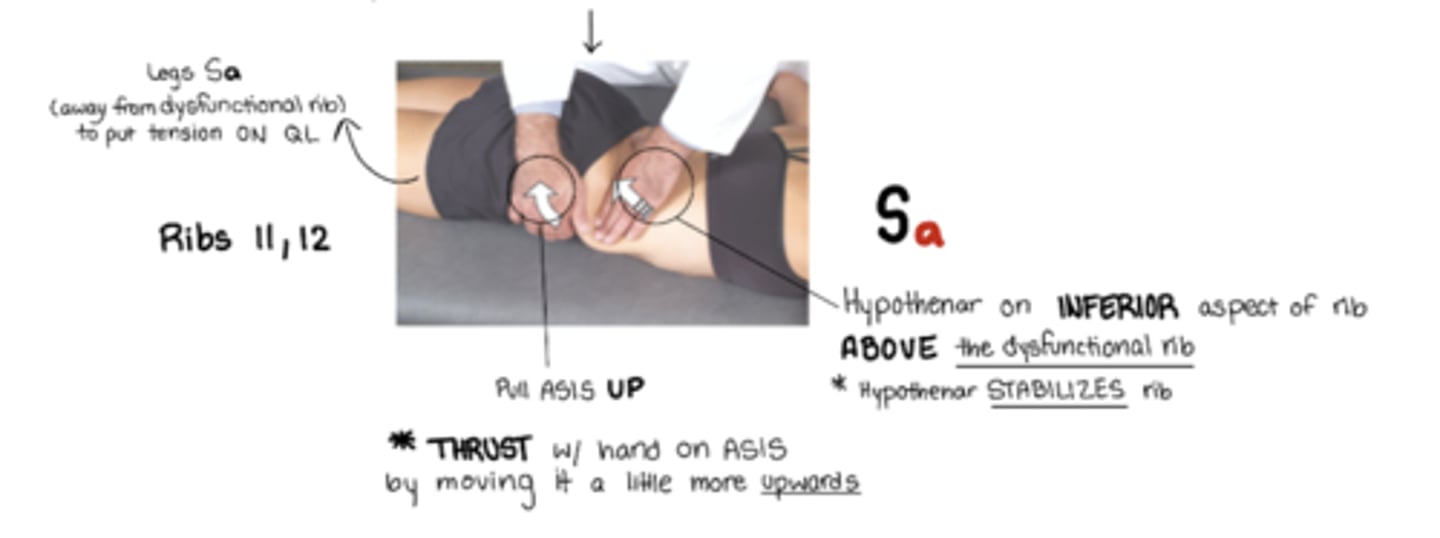 <p>Sa = legs away from dysfunctional rib</p><p>stand OPPOSITE of dysfunctional rib</p><p>active hand: hand pulls UP on ASIS to push rib back down</p><p>other hand: hypothenar eminence on inferior aspect of rib ABOVE dysfunctional rib to stabilize rib</p><p>ribs stuck UP</p>