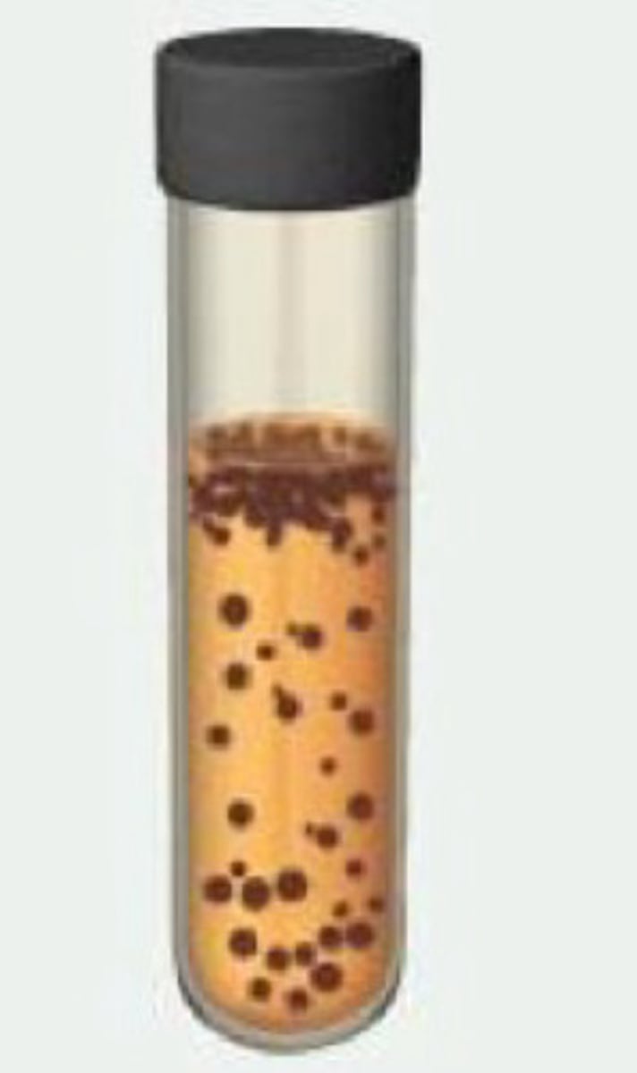 <p>name what kind of microbe in the test tube and describe the growth pattern</p>