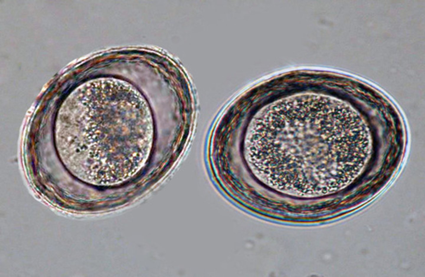 <p>What parasite is this if it is from a cat</p>