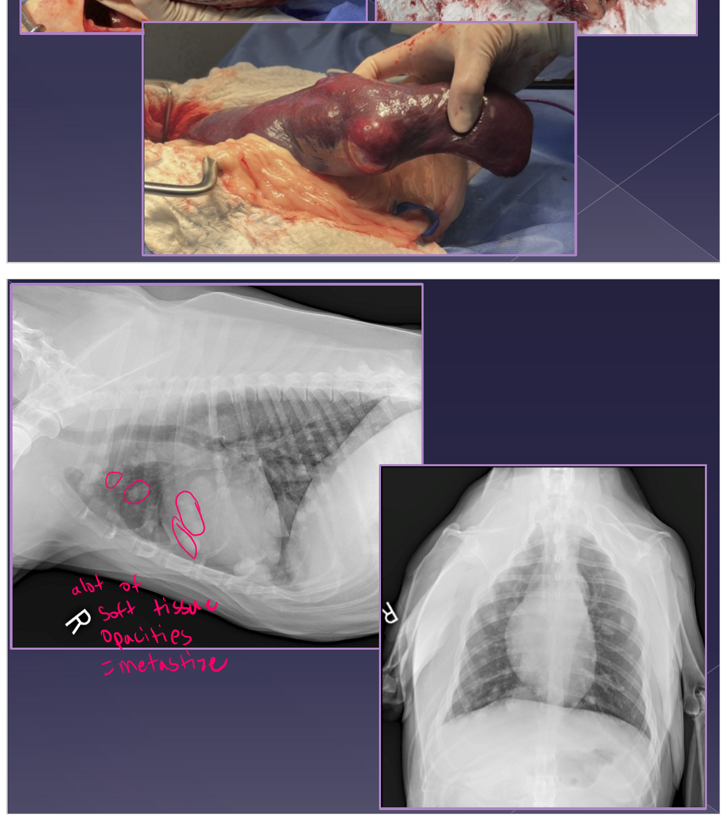 <p>Neoplasia of the spleen </p>