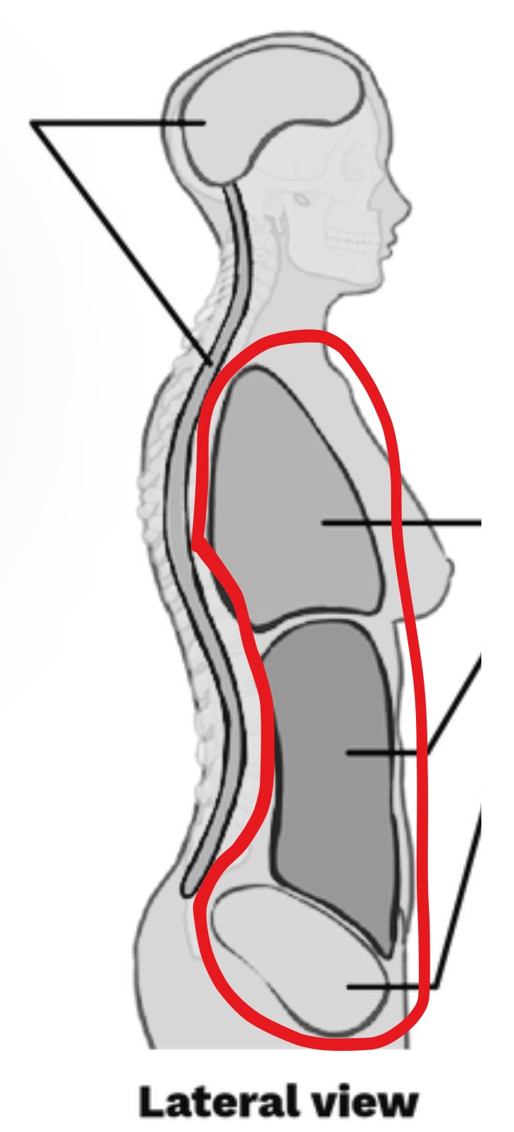 <p>What cavity is this?</p>
