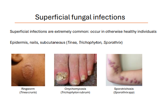 <p>Superficial infections are extremely common: occur in otherwise <strong>healthy individuals</strong></p><ol><li><p>Ringworm (Tinea cruris)</p></li><li><p>Onychomycosis (Trichophyton rubrum)</p></li><li><p>Sporotrichosis (Sporothrixspp)</p></li></ol><p></p>