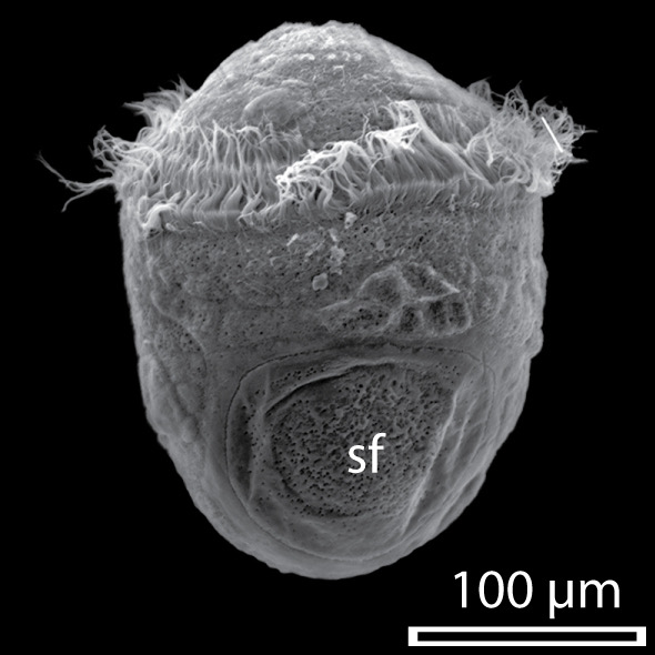 <p>4 classes: Clitellata, Polychaeta, Echiurans, Sipunculans</p><p>Characteristics: chitinous setae (not in sippies), repeating segments</p><p>Larva: trochophore (ciliates round guy)</p>