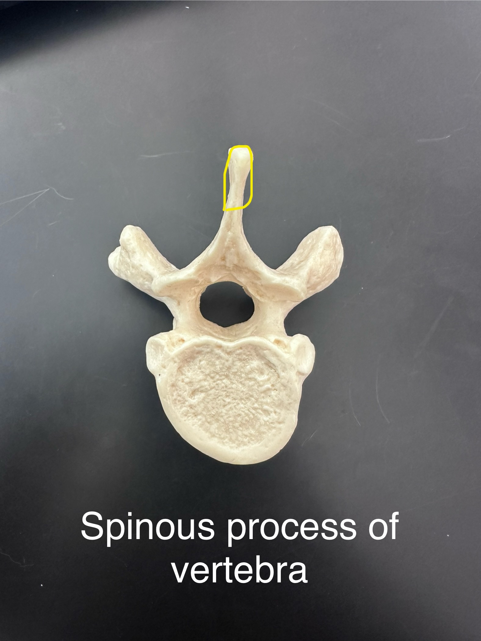 <p>Spinous process</p>