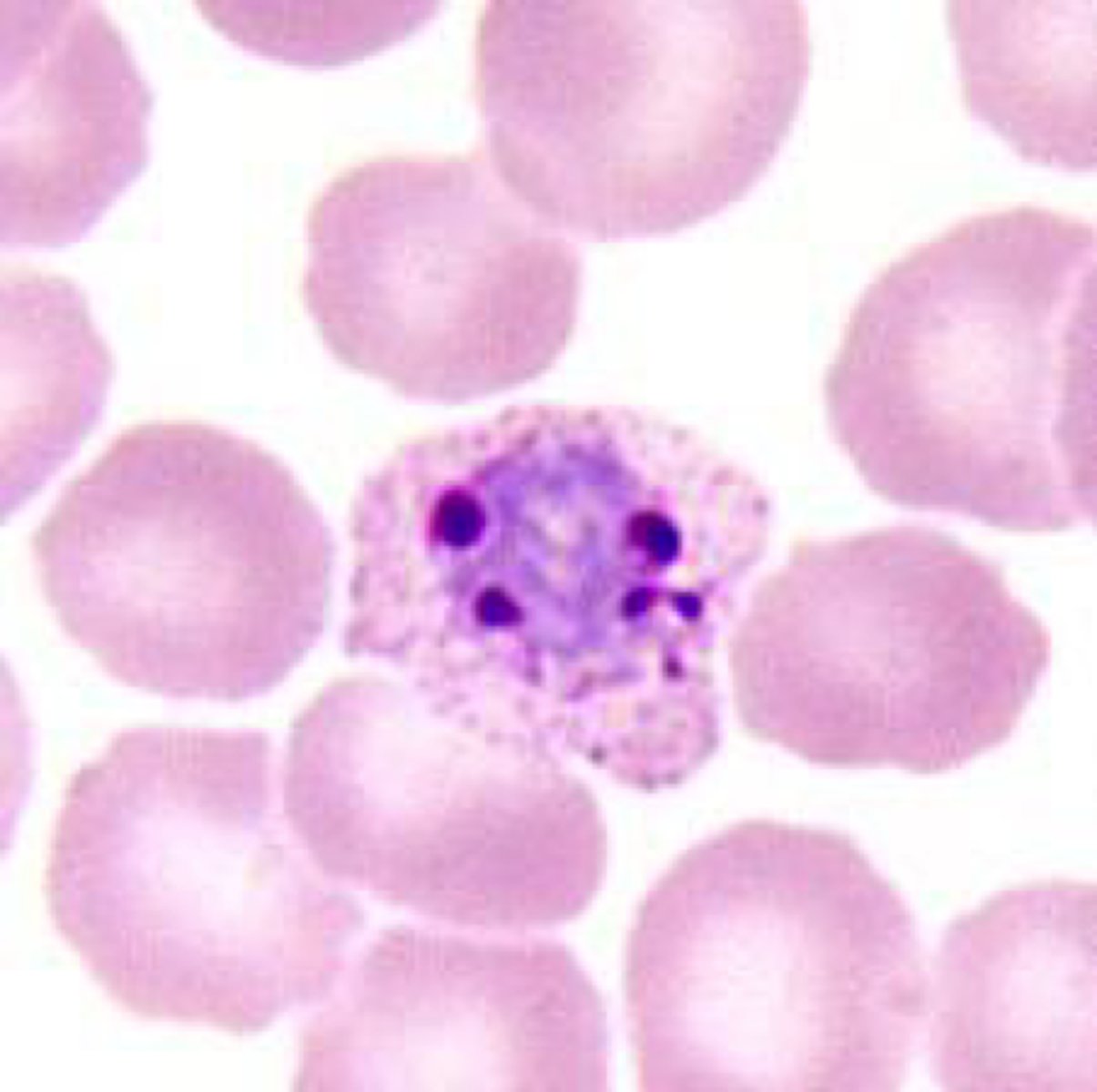 <p>Name the stage and species.</p><p>NOTE: 6-14 merozoites.</p>