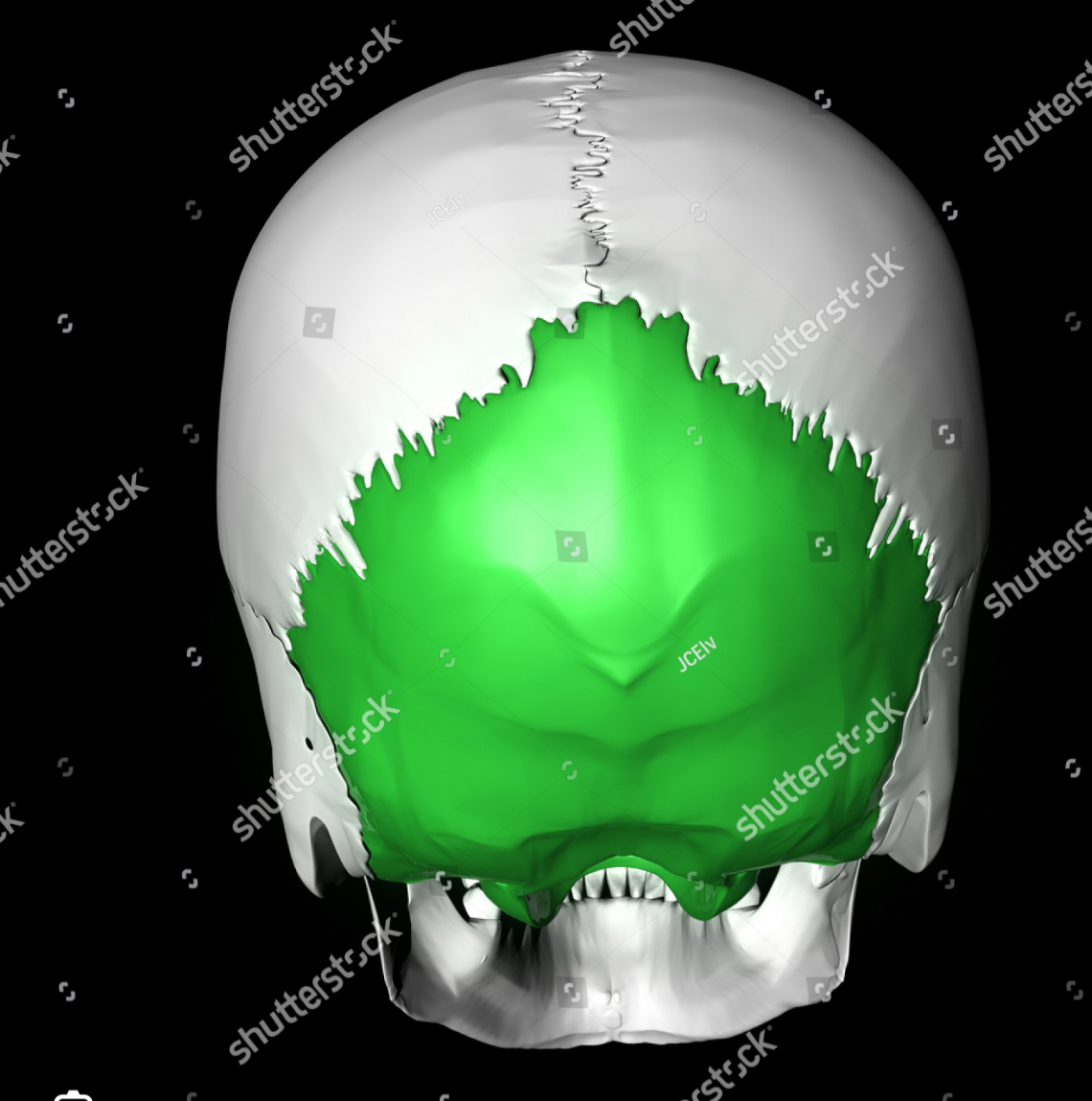 <p>Occipital bone</p>
