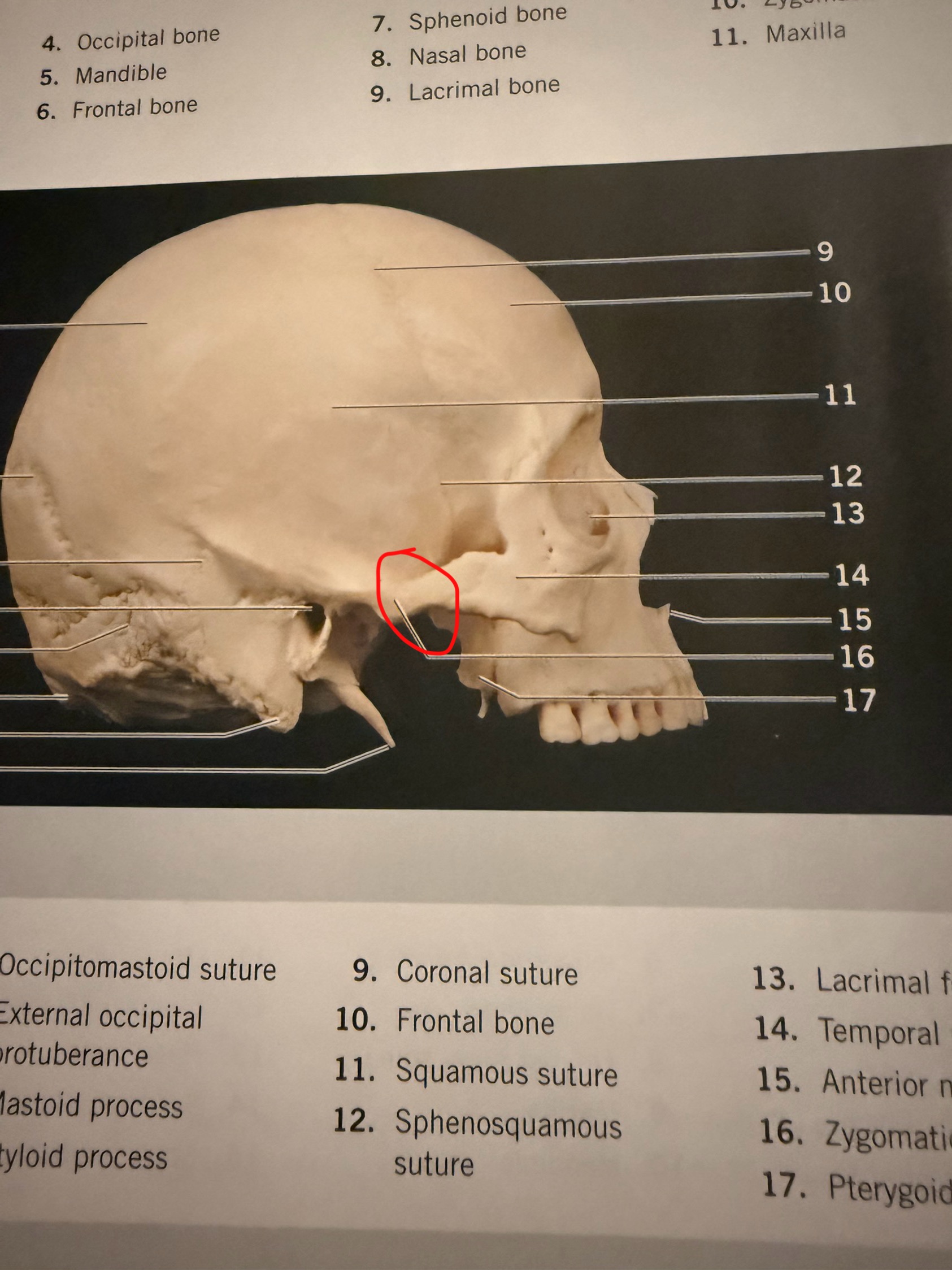 term image