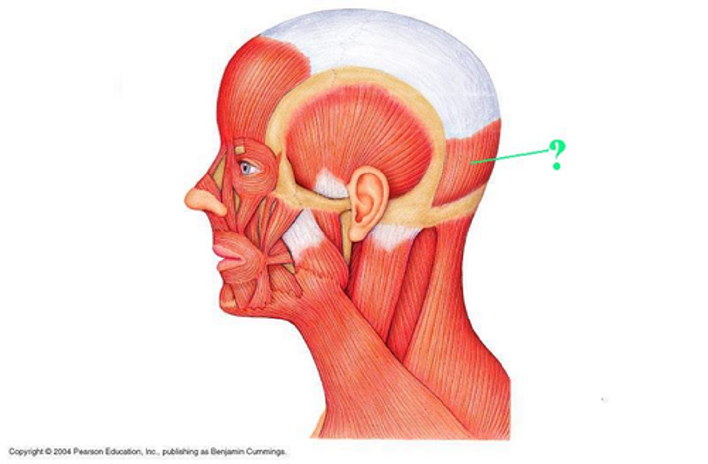 <p>Idenitfy the indicated muscle</p>