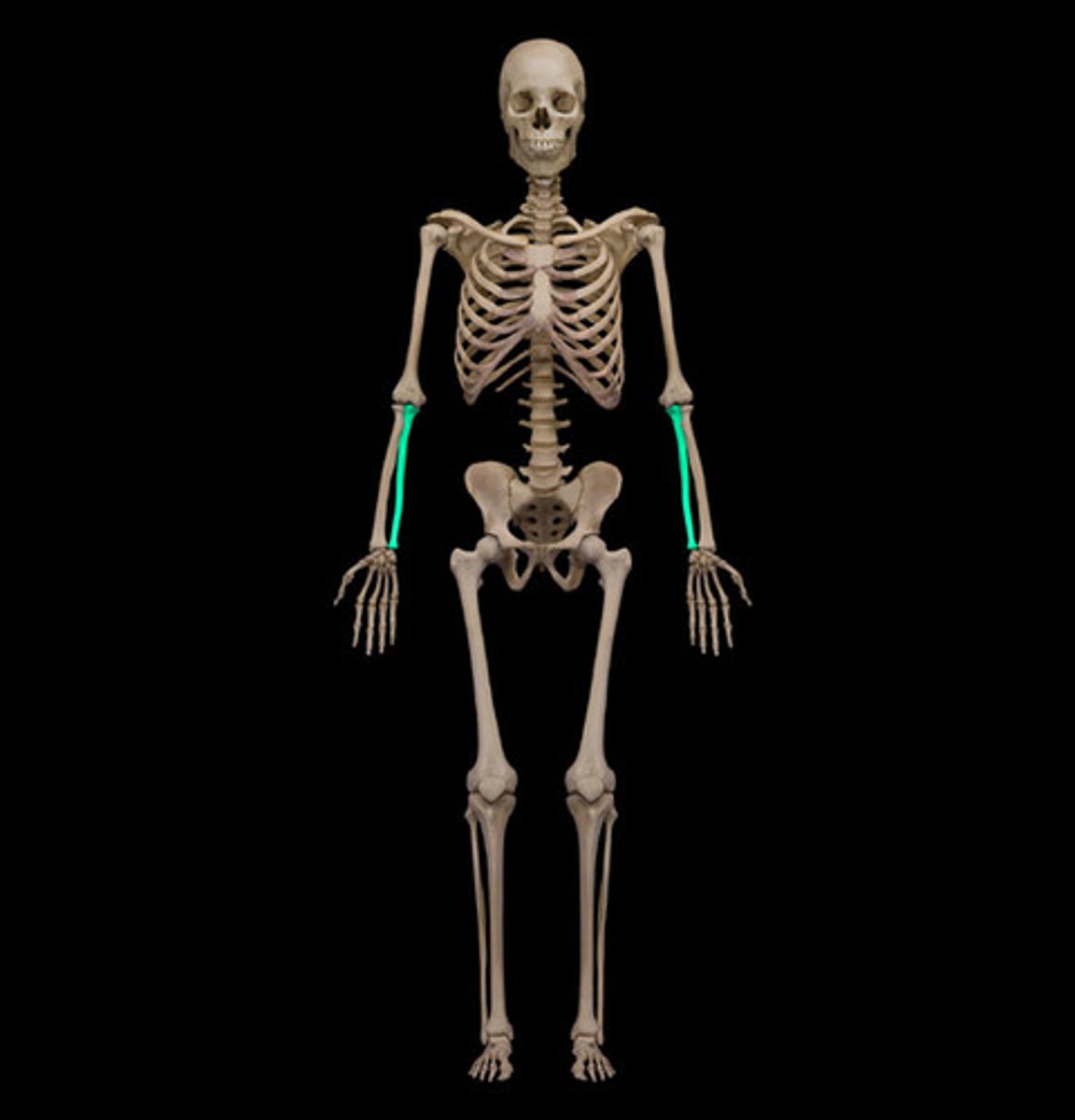 <p>What bone is this?</p>