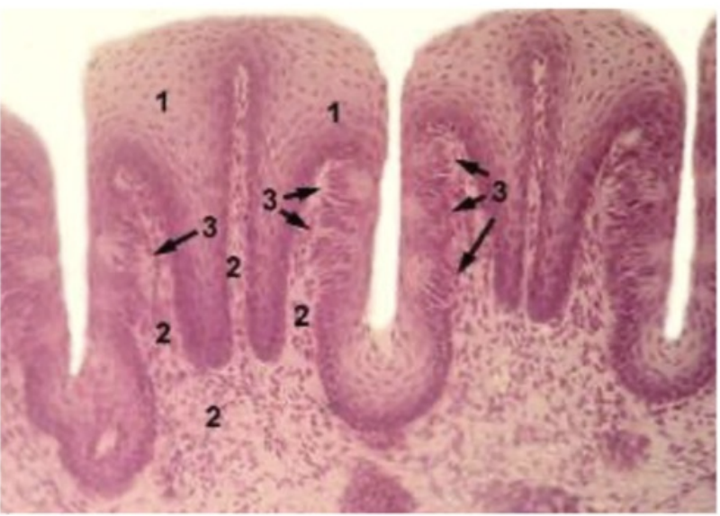 <p><strong><u>Epithelium:</u> </strong><span style="color: green"><strong>Nonkeratinized stratified squamous </strong></span></p><p><strong><u>Lamina propria:</u> </strong>Forms <span style="color: green"><strong>connective tissue core </strong></span>within each <span style="color: green"><strong>fold</strong></span><strong> </strong></p><p><strong><u>Taste buds:</u> </strong><span style="color: green"><strong>Present</strong></span><strong> </strong>in <span style="color: green"><strong>walls</strong></span><strong> </strong>of <span style="color: green"><strong>cleft</strong></span></p><p><strong><u>Well developed in:</u> </strong><span style="color: green"><strong>Horse</strong></span><strong> </strong>and <span style="color: green"><strong>dogs</strong></span><strong> </strong></p><p><strong><u>Absent in:</u> </strong><span style="color: green"><strong>Ruminants</strong></span><strong> </strong></p><p></p>
