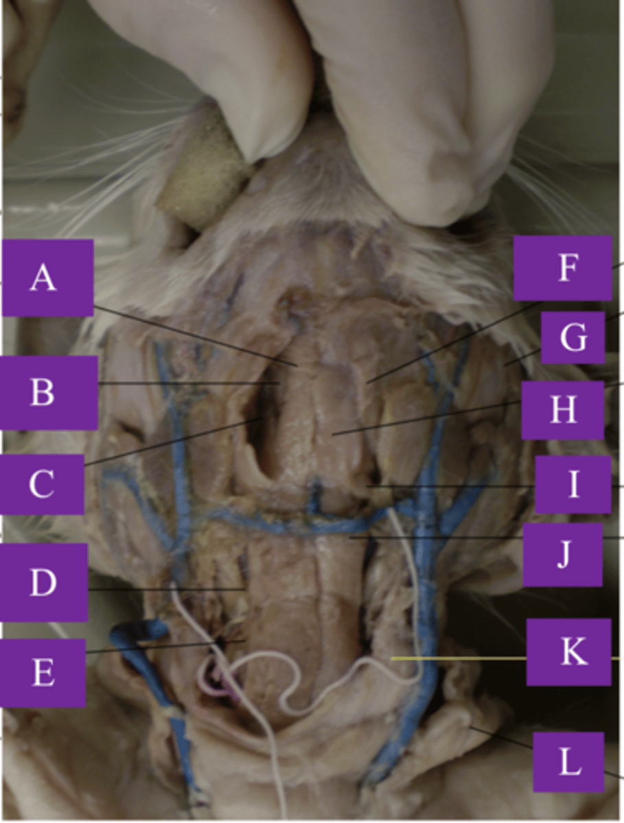 <p>What is letter C?</p>