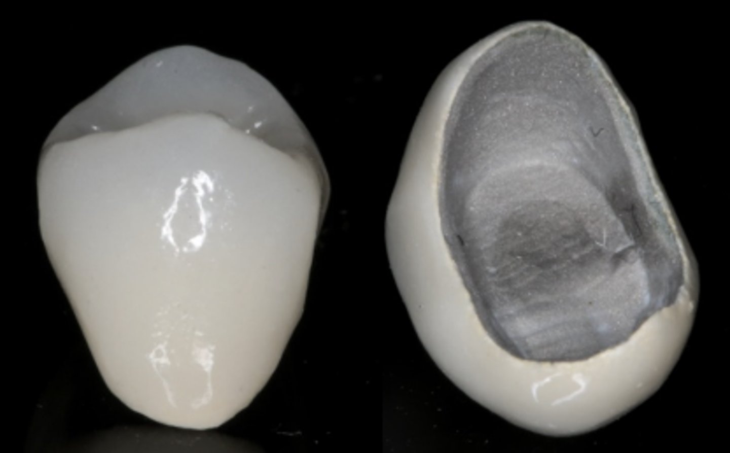 <p>What type of crown is shown?</p>