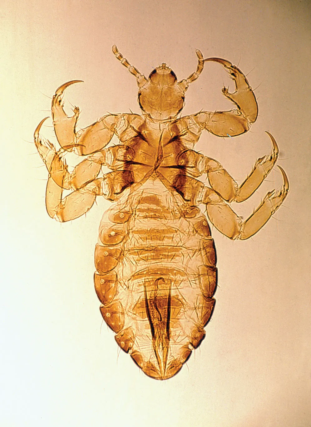 <p>2-4 mm</p>