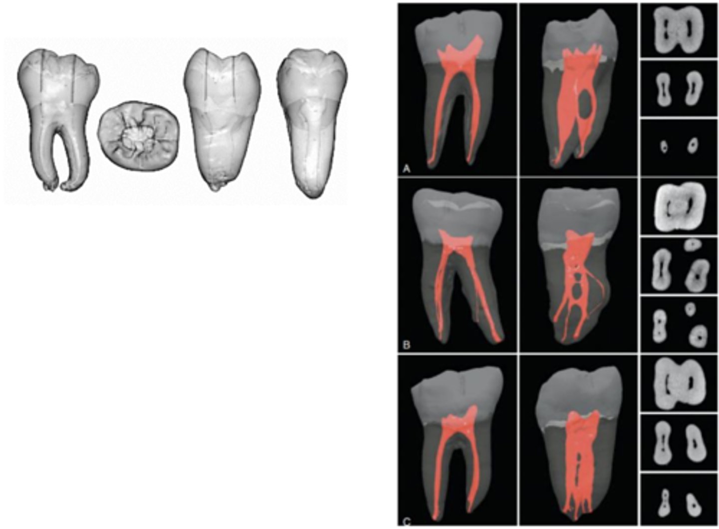 <p>distal</p>